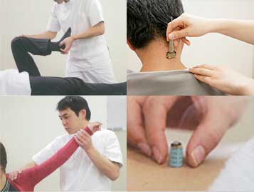 訪問鍼灸マッサージ